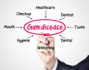 gum disease Dallas TX