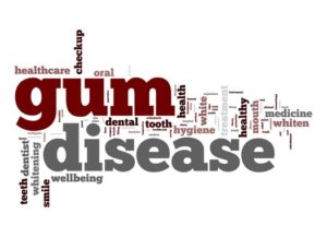 gum disease Dallas